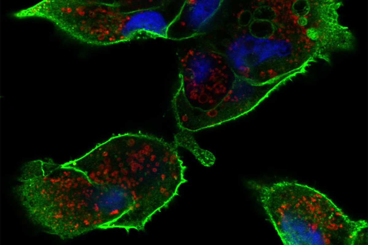 Kidney cancer cells growing in culture.