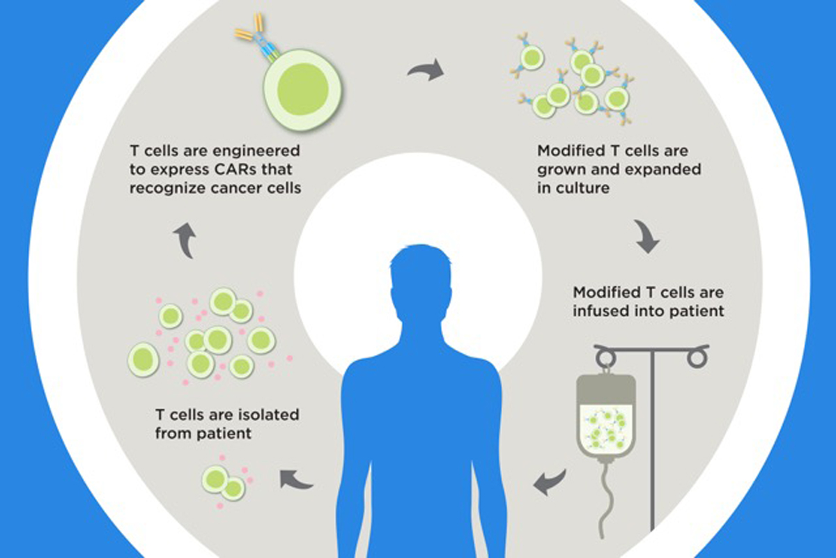 CAR T Cell Therapy process