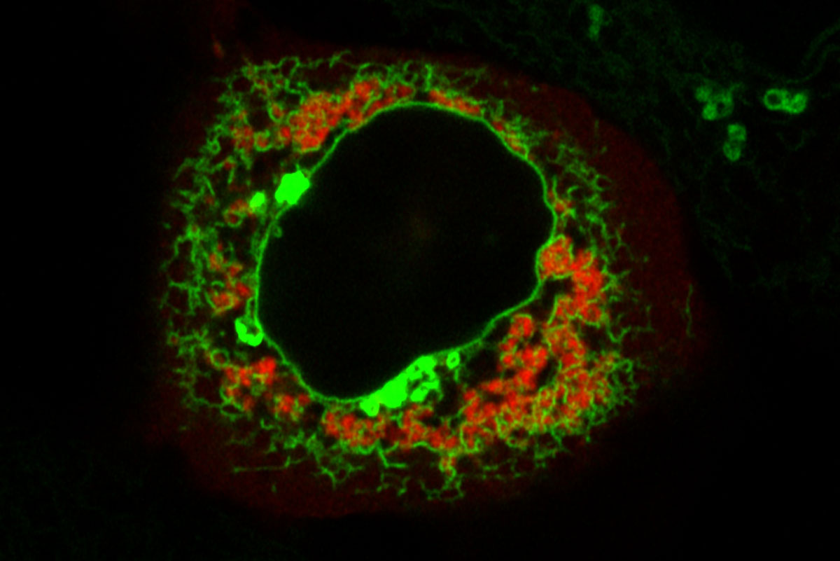 organelle