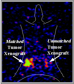 Planar gamma camera image of [131I]-FIAU-labeled T cells 4 days post-injection in a SCID mouse bearing a matched and an unmatched EBV lymphoma xenograft