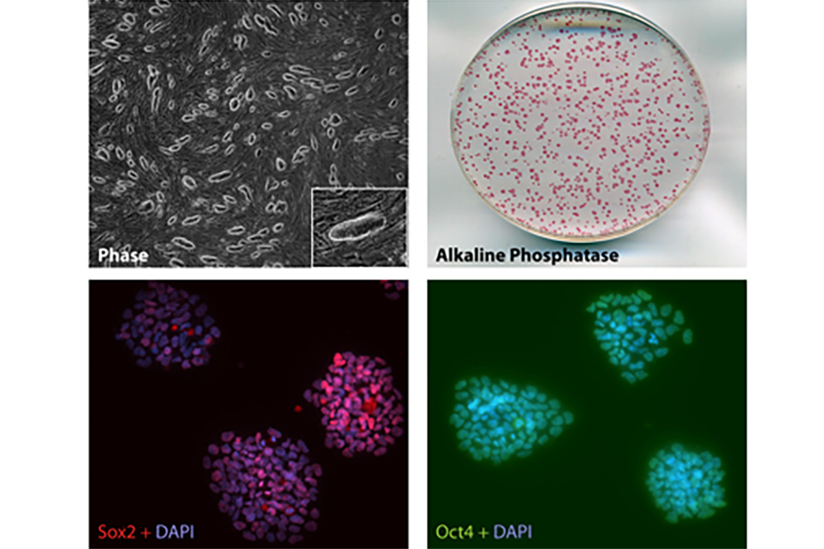 error-prone DNA repair