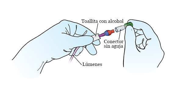 Figura 4. Gire el nuevo conector sin aguja sobre el lumen