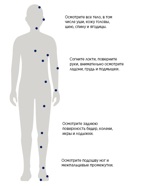 Рисунок 1.  Советы по проверке кожи.