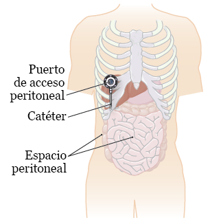 Figura 1. Espacio peritoneal
