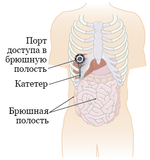 Рисунок 1.  Полость брюшины