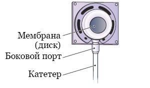 Рисунок 2.  Порт и катетер